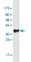 Anti-OSBP2 Mouse Monoclonal Antibody [clone: 2B4]