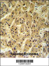 Anti-SC24A Rabbit Polyclonal Antibody (AP (Alkaline Phosphatase))