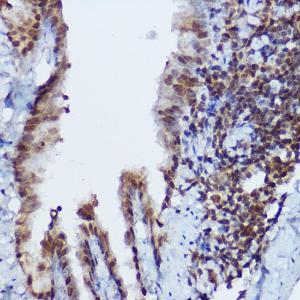 Immunohistochemistry analysis of paraffin-embedded mouse lung using Anti-RBMY1A1 Antibody (A308659) at a dilution of 1:100 (40x lens). Perform high pressure antigen retrieval with 10 mM citrate buffer pH 6.0 before commencing with IHC staining protocol.