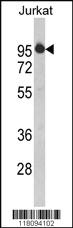 Anti-HTATSF1 Rabbit Polyclonal Antibody