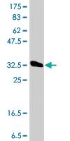 Anti-TFB2M Mouse Polyclonal Antibody