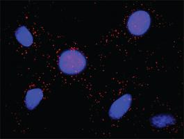 Anti-BUB1 + APC Antibody Pair