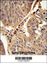 Anti-PEX16 Rabbit Polyclonal Antibody (FITC (Fluorescein Isothiocyanate))