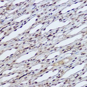 Immunohistochemistry analysis of paraffin-embedded rat kidney using Anti-RBMY1A1 Antibody (A308659) at a dilution of 1:100 (40x lens). Perform high pressure antigen retrieval with 10 mM citrate buffer pH 6.0 before commencing with IHC staining protocol.