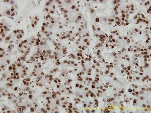 Anti-HMGB1 Mouse Monoclonal Antibody [clone: 1D5]