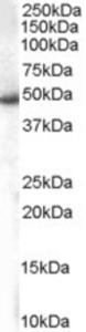 EB06217 staining (1µg/ml) of Jurkat lysate (RIPA buffer, 35µg total protein per lane). Primary incubated for 1 hour. Detected by western blot using chemiluminescence.