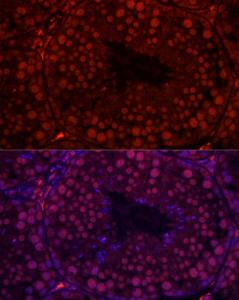 Immunofluorescence analysis of mouse testis cells using Anti-RBMY1A1 Antibody (A308659) at a dilution of 1:100 (40x lens). DAPI was used to stain the cell nuclei (blue).