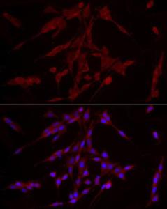 Anti-ERK1 antibody