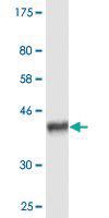 Anti-ABCC8 Mouse Monoclonal Antibody [clone: 3E1]