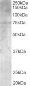 EB06223 (1 µg/ml) staining of Human Brain lysate (35 µg protein in RIPA buffer).  Primary incubation was 1 hour.  Detected by chemiluminescence.