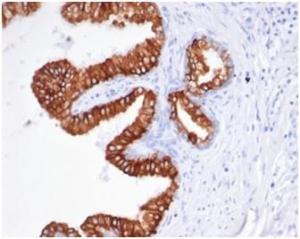 Anti-EpCAM Mouse Recombinant Antibody [Clone: rEGP40/826]