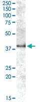 Anti-APOL6 Goat Polyclonal Antibody