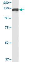 Anti-CEMIP Polyclonal Antibody Pair