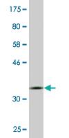 Anti-TFB2M Mouse Monoclonal Antibody [clone: 2E10]