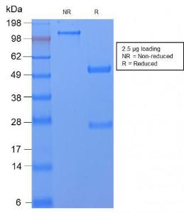 Anti-CD59 antibody