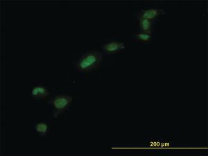 Anti-HMGB1 Mouse Monoclonal Antibody [clone: 1D5]