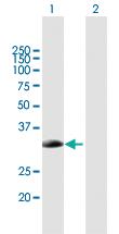 Anti-SMN2 Mouse Polyclonal Antibody