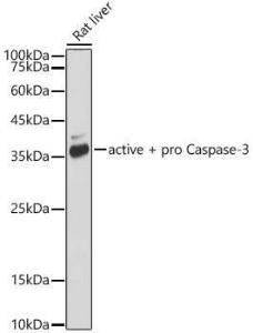 Western blot analysis of extracts of Rat liver, using Anti-Caspase-3 Antibody [ARC0133] (A308661) at 1:1,000 dilution. The secondary antibody was Goat Anti-Rabbit IgG H&L Antibody (HRP) at 1:10,000 dilution.