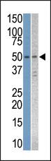 Anti-STK38L Rabbit Polyclonal Antibody