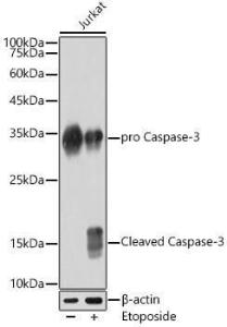 Western blot analysis of extracts of Jurkat, using Anti-Caspase-3 Antibody [ARC0133] (A308661) at 1:1,000 dilution. Jurkat cells were treated by Etoposide (25 uM) at 37°C for 5 hours. The secondary antibody was Goat Anti-Rabbit IgG H&L Antibody (HRP) at 1:10,000 dilution.