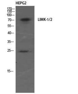 Western blot analysis of HEPG2 using Anti-LIMK1 + LIMK2 Antibody