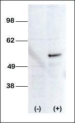 Anti-STK38L Rabbit Polyclonal Antibody