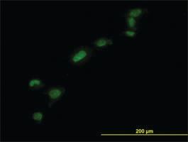 Anti-HMGB1 Mouse Monoclonal Antibody [clone: 1D5]