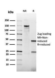 Anti-Thrombomodulin Mouse Recombinant Antibody [clone: rTHBD/1591]