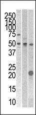 Anti-STYK1 Rabbit Polyclonal Antibody