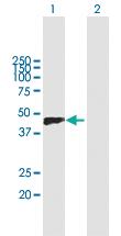 Anti-VCAN Mouse Polyclonal Antibody