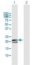 Anti-MYL1 Mouse Polyclonal Antibody