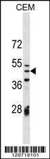 Anti-IZUM1 Rabbit Polyclonal Antibody (HRP (Horseradish Peroxidase))