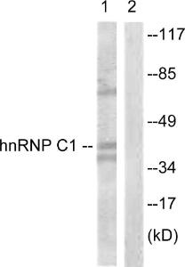 Western blot analysis of lysates from HUVEC cells, treated with EGF 200ng/ml 5' using Anti-hnRNP C1 + C2 Antibody The right hand lane represents a negative control, where the antibody is blocked by the immunising peptide