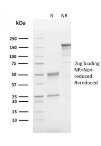 SDS-PAGE analysis of Anti-CD63 Antibody [LAMP3/2790] under non-reduced and reduced conditions; showing intact IgG and intact heavy and light chains, respectively. SDS-PAGE analysis confirms the integrity and purity of the antibody