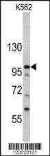 Anti-MTBP Rabbit Polyclonal Antibody