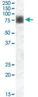 Anti-NUAK1 Goat Polyclonal Antibody