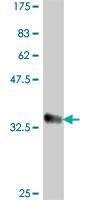 Anti-CCL2 Mouse Polyclonal Antibody