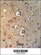 Anti-GPHN Rabbit Polyclonal Antibody (FITC (Fluorescein Isothiocyanate))