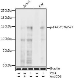 Western blot analysis of extracts of Jurkat and Raji cells, using Anti-FAK (phospho Tyr576 + Tyr577) Antibody (A11014) at 1:1000 dilution