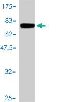 Anti-FASN Mouse Monoclonal Antibody [clone: 3F2-1F3]