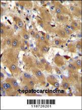 Anti-HPR Rabbit Polyclonal Antibody (APC (Allophycocyanin))