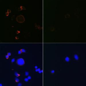 Immunofluorescence analysis of HeLa Treated with Etoposide, HeLa cells using Anti-Caspase-3 Antibody [ARC0133] (A308661) at a dilution of 1:100 (40x lens). DAPI was used to stain the cell nuclei (blue).