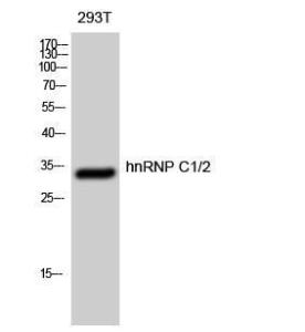 Western blot analysis of 293T cells using Anti-hnRNP C1 + C2 Antibody