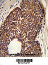 Anti-MTBP Rabbit Polyclonal Antibody