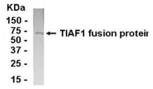 Anti-Anthrax LF Mouse Monoclonal Antibody [clone: 5F502.2]