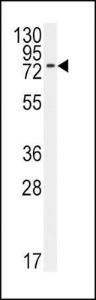 Anti-BMPR1A Rabbit Polyclonal Antibody (AP (Alkaline Phosphatase))