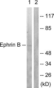 Anti-EFNB1 and EFNB2 antibody