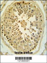 Anti-LIM/homeobox Protein 1.2 Rabbit Polyclonal Antibody (Biotin)