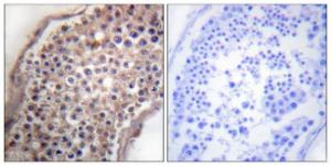 Anti-EFNB1 and EFNB2 antibody