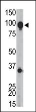 Anti-GRM8 Rabbit Polyclonal Antibody